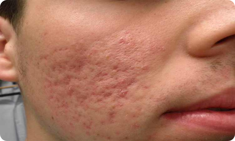 موادغذایی مفید برای پوست